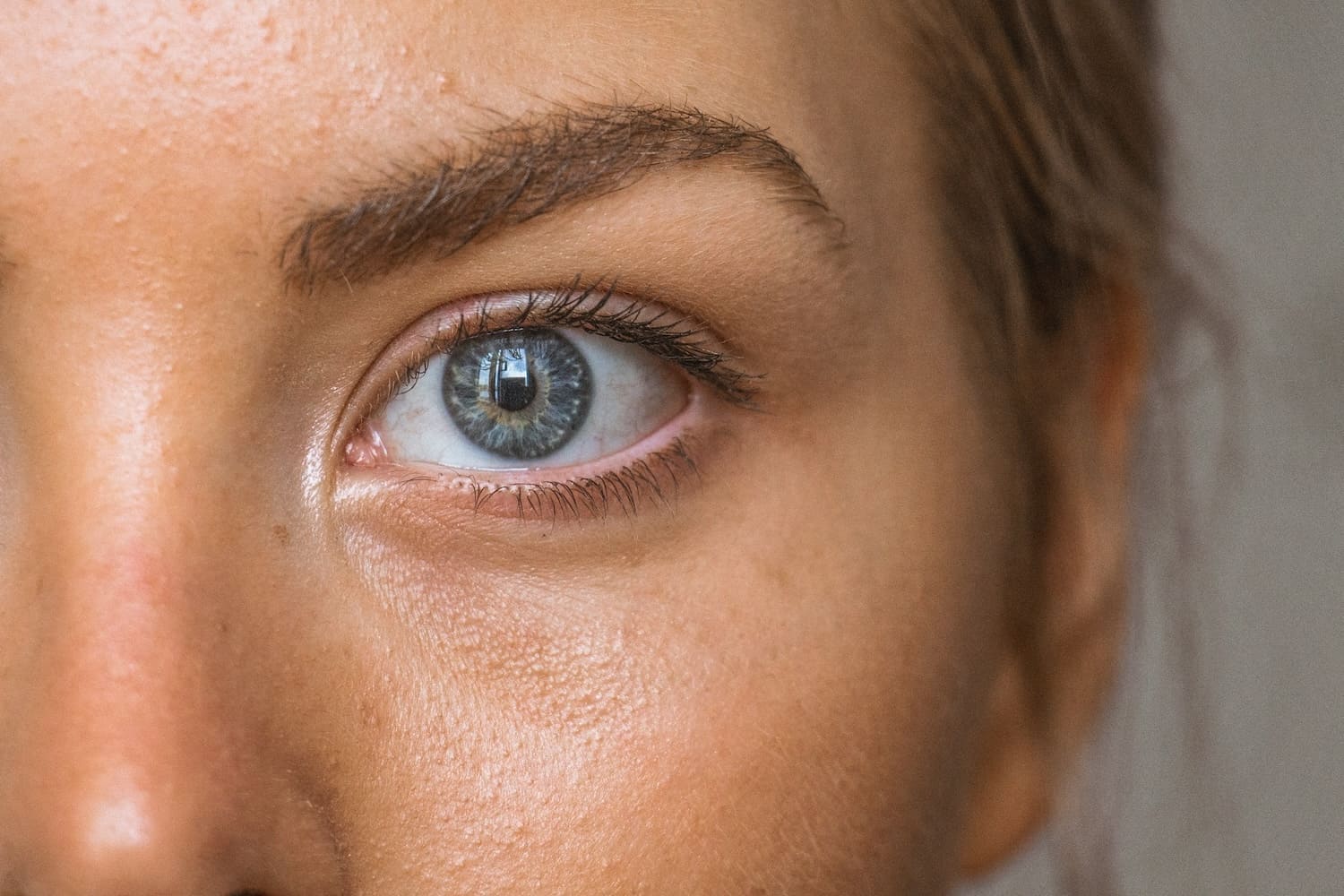 Tratamiento de ojeras en Mallorca: Plinest Eye, Carboxiterapia, NCTF 135HA y Redensity II. Pack EYE REFRESH 360 desde 399€ en CMC Vitaclinic.