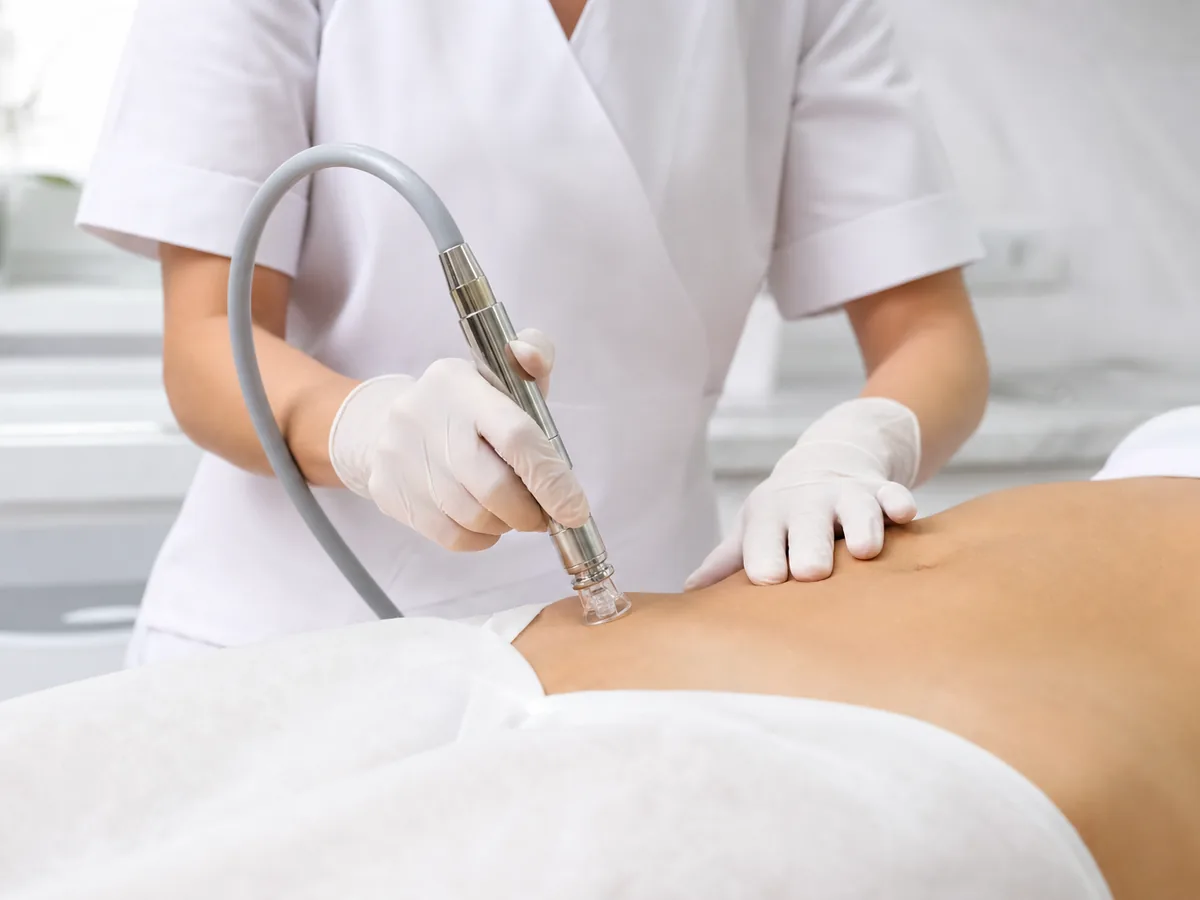 Carboxiterapia mallorca en CMC Vitaclinic